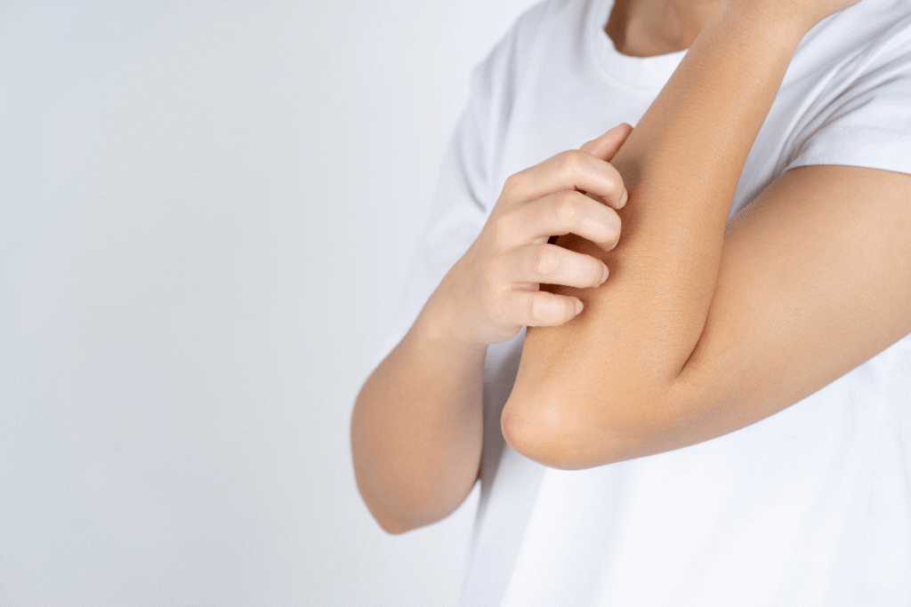 nietolerancja fruktozy objawy skorne